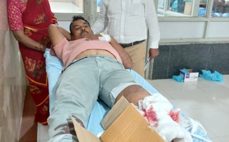 टेंपो ने बाइक सवार भाजपा नेता आलोक सिंह को मारी टक्कर,घायल अवस्था में ट्रामा सेंटर रेफर